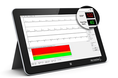VectraplexECG